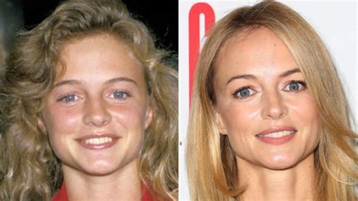 Heather Graham Plastic Surgery
