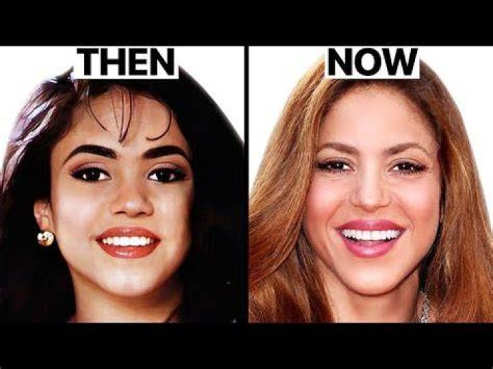 Hilary Swank Plastic Surgery Before and After