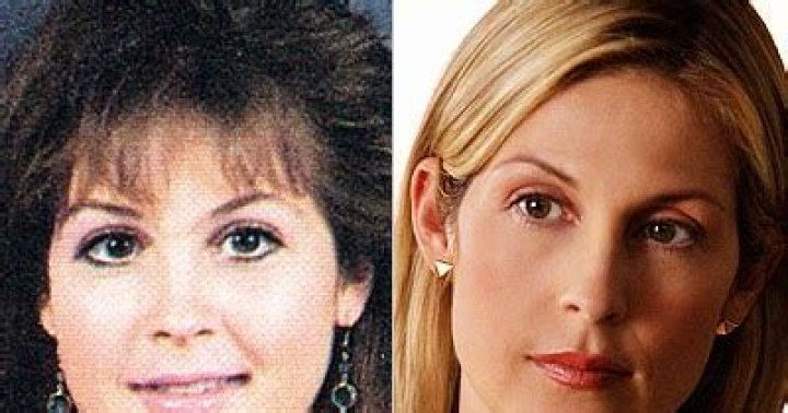 Kelly Rutherford Plastic Surgery Before and After